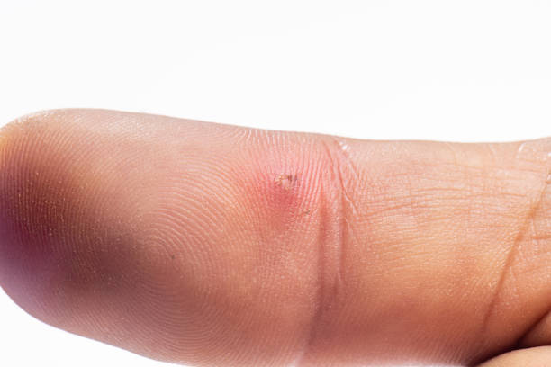 A senior man's index finger on left hand