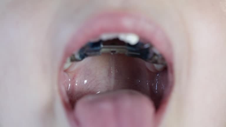 The little girl opens mouth and shows her long tongue, throat and jaw expander.