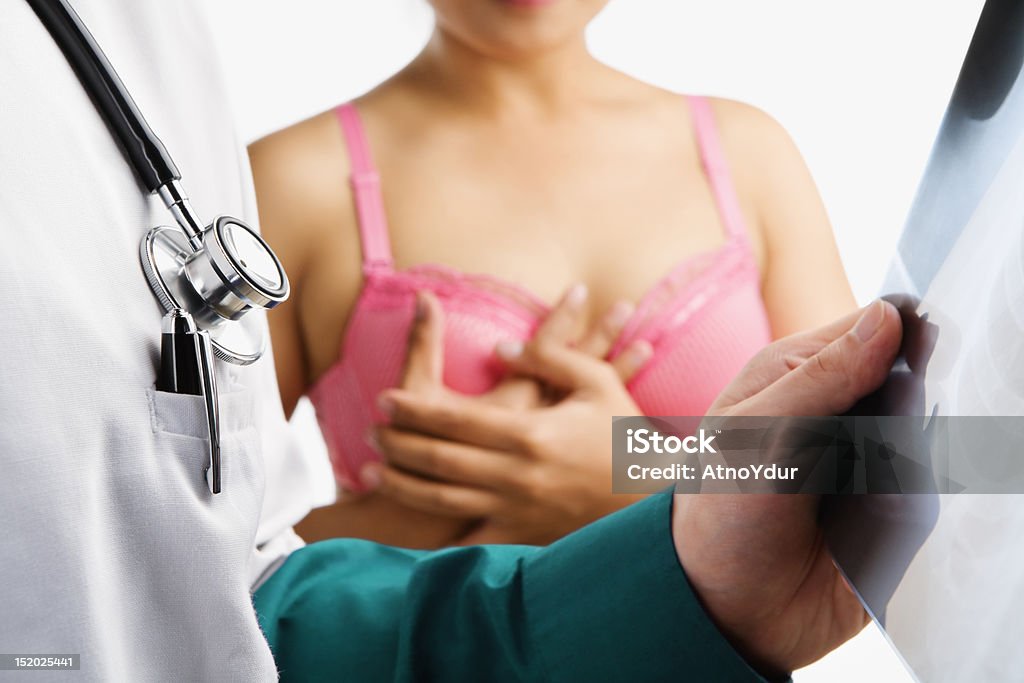 Medico tenendo roentgen film e donna sul reggiseno rosa - Foto stock royalty-free di Abbigliamento intimo