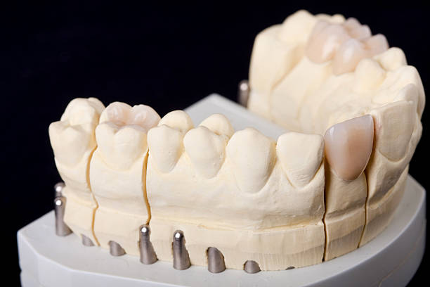istock detail dental wax model 152126562