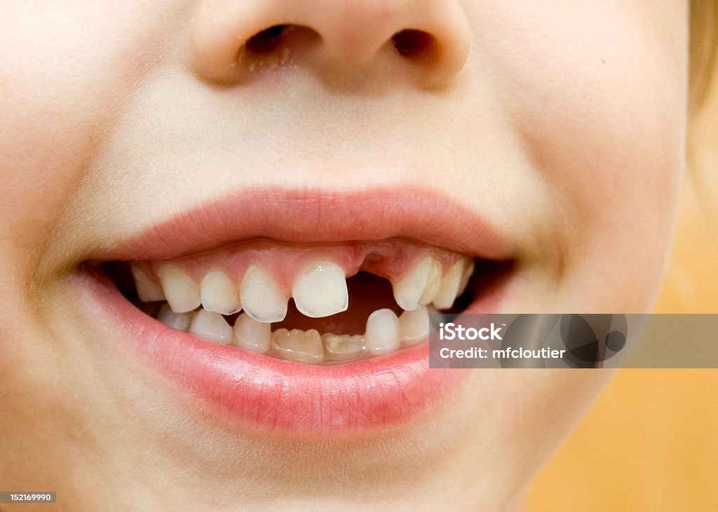 Criança sorrir com os dentes faltando - Foto de stock de Criança royalty-free