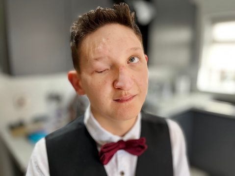 Portrait of teenage boy with partial blindness dressed in formal attire for his prom