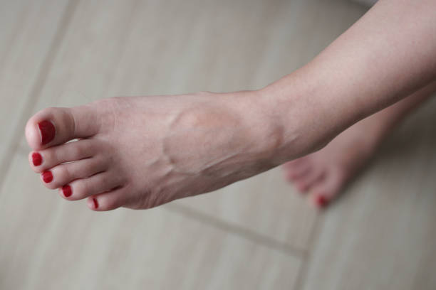 istock Female feet with red toe nails 1524113765