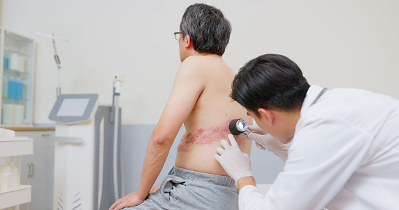 asian male doctor is examining to man patient about his shingles disease with skin magnifying glass