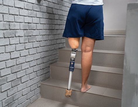Low angle view at disabled woman with prosthetic leg walking on stair at home