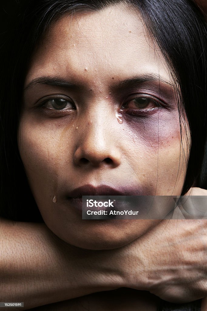 Woman being chocked and hurt Woman being chocked and hurt, concept for domestic violence Bruise Stock Photo