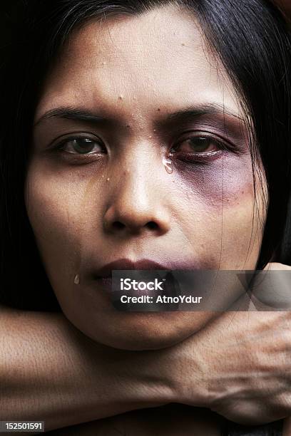 Woman Being Chocked And Hurt Stock Photo - Download Image Now - Bruise, Human Face, Women