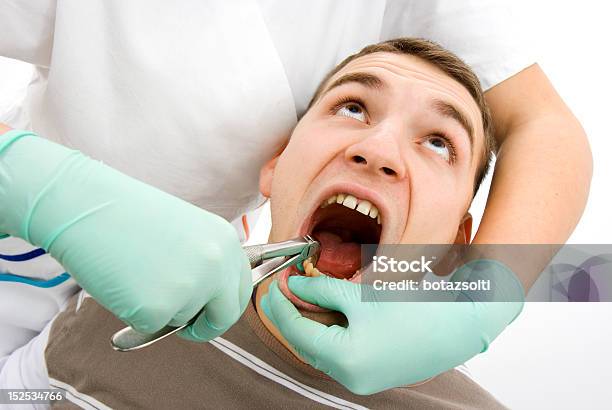 Estrazione Dentale - Fotografie stock e altre immagini di Accudire - Accudire, Apparecchiatura odontoiatrica, Attrezzatura