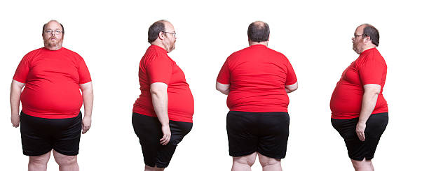 Obesity stock photo