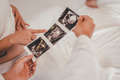 Concept Motherhood and Pregnant, Prenatal care and pregnancy. Male doctor showing ultrasound picture to pregnant woman with pregnant woman in hospital.