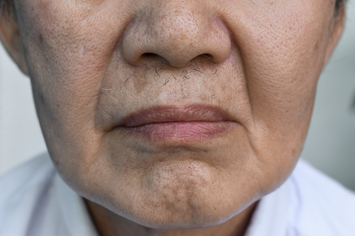 Skin folds and creases in face of Asian elder man.