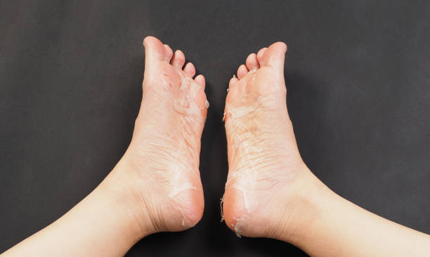 Foot peeling or remove dead skin on black background.