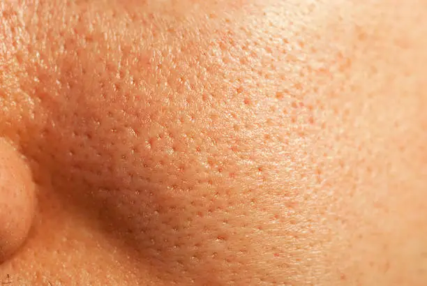 Close-up of human facial pores
