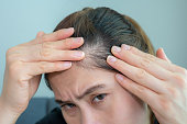 Cropped shot of Asian woman worrying about her forehead with part of her thin hair, she had hair loss problem.