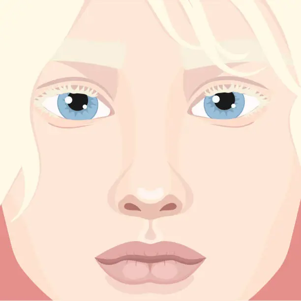 Vector illustration of Beautiful albino girl face close up. Woman with blondie hair and albinism. Genetic rare appearance. Vector illustration