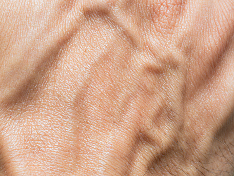 Close up skin texture