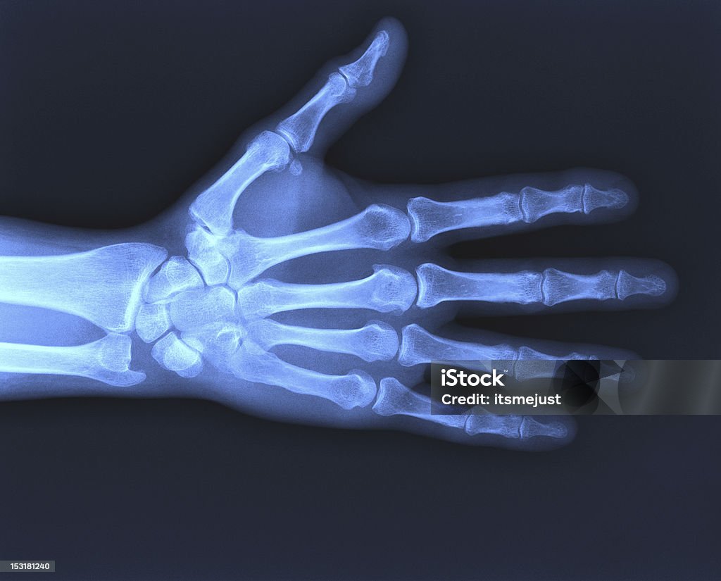 X-ray main - Photo de Articulation du corps humain libre de droits