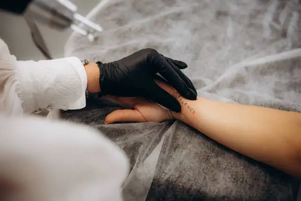 Beautician using laser device to remove an unwanted tattoo from female arm. Concept of erasing tattoos as an expensive procedure in a cosmetology clinic.