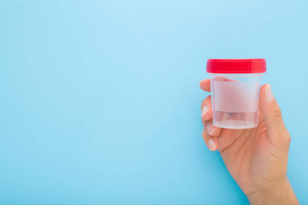Young adult woman hand holding transparent plastic container for urine or other analysis test on light blue background. Pastel color. Healthcare concept. Closeup. Empty place for text. Front view. stock photo