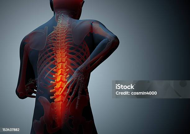 Back Hurt Stock Photo - Download Image Now - Human Spine, Physical Injury, Spine - Body Part