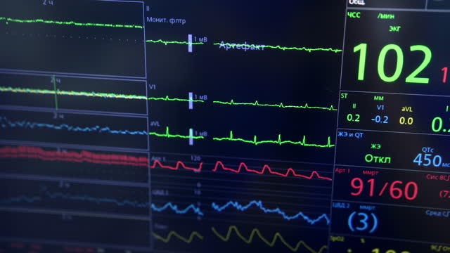 Patient's life signs on the equipment monitor. Controlling and checking the condition of a person under surgery. Extreme close up.