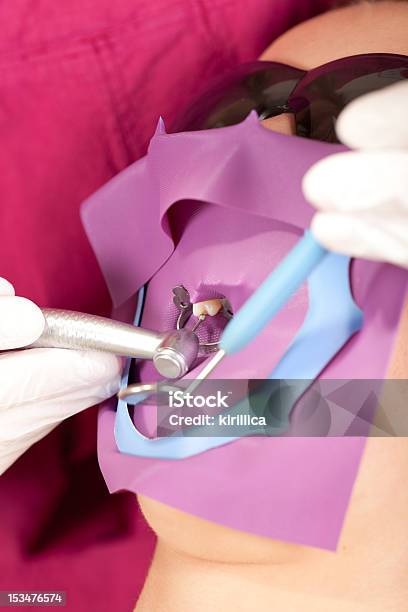 Stomatology É Divertido Perfuração De Um Dente Isolado - Fotografias de stock e mais imagens de Quadrado de Látex