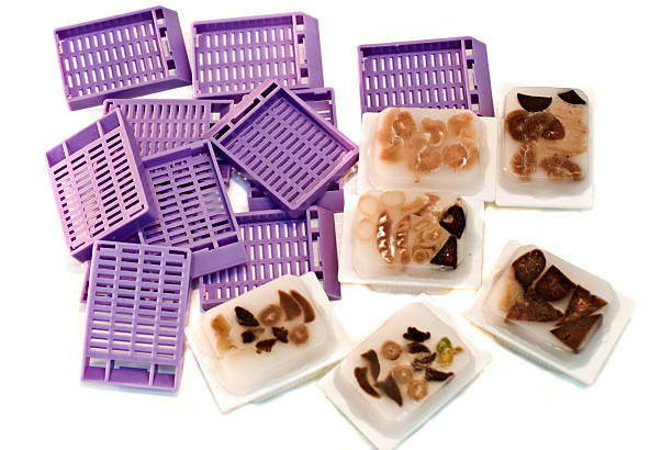 istock histopathology cassette with organ embedded paraffin-white isolation 153480333