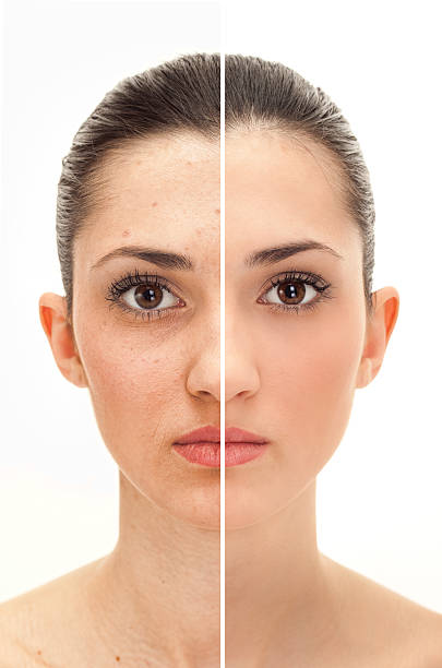 istock beauty concept before and after retouch 153480534