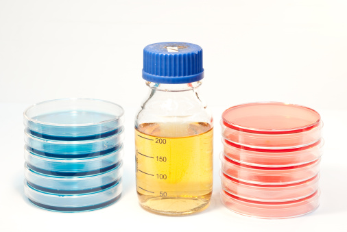 bacteriology equipment (petri dish, agar-media, bottle)