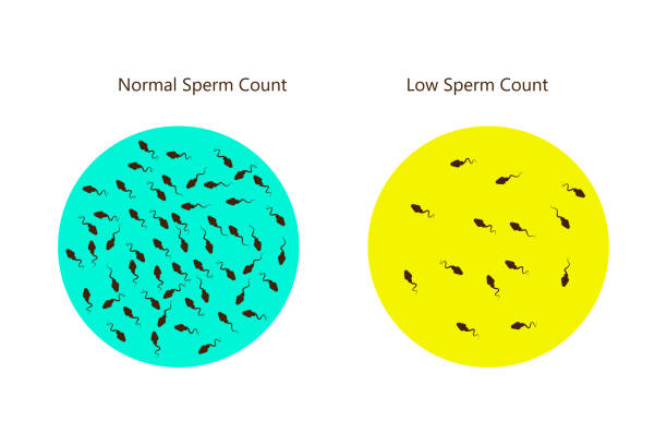 Web normal and low sperm count illustration. Male infertility oligospermia. Structure of the sperm. Vector. eps 10 tadpole swimming stock illustrations