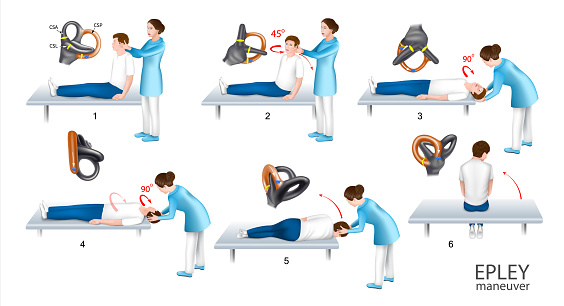 Epley maneuver is a methodological guide for students with the help of a doctor step by step instructions. Treatment of benign positional paroxysmal vertigo. Vector.