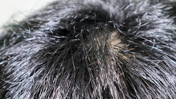 istock Japanese man's scalp close up 1536353159