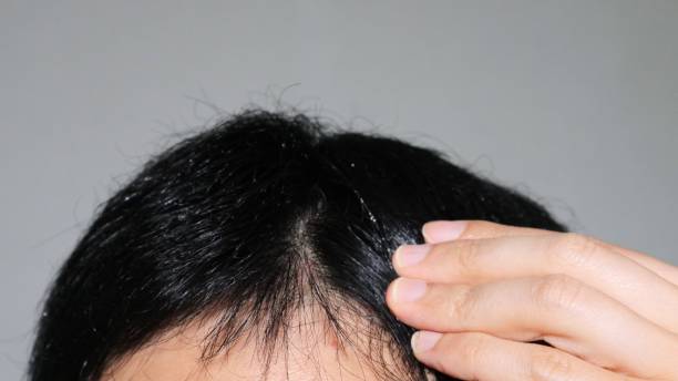 istock Close-up of a thin-haired Japanese man 1536361865