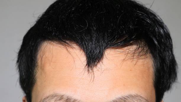 istock Japanese man with thin hair 1536368634