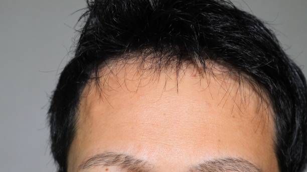 istock Japanese man with thin hair 1536369164