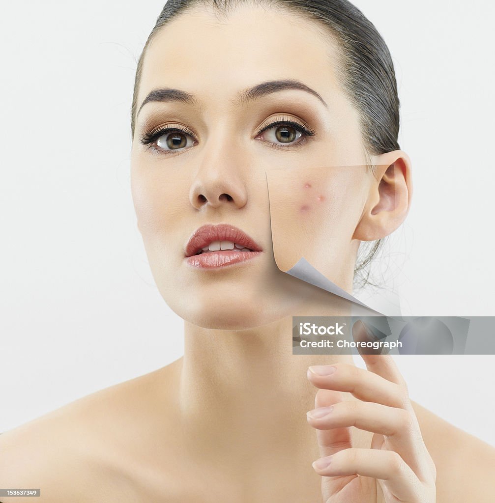 beauty portrait a beauty girl on the grey background Acne Stock Photo