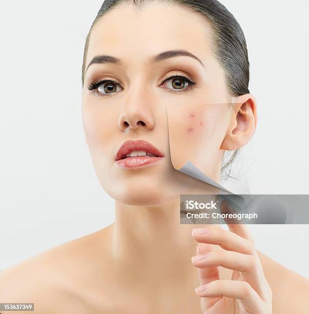 Beauty Portrait Stock Photo - Download Image Now - Acne, Beauty Treatment, Women