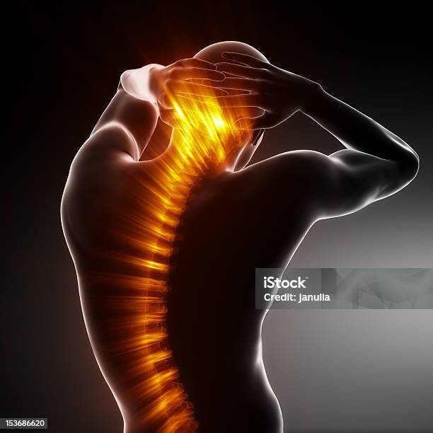 Pain In Spine Medical Concept Stock Photo - Download Image Now - Adult, Anatomy, Concepts