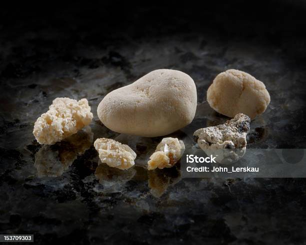 Камни В Почках — стоковые фотографии и другие картинки Камень в почке - Камень в почке, Камень, Моча