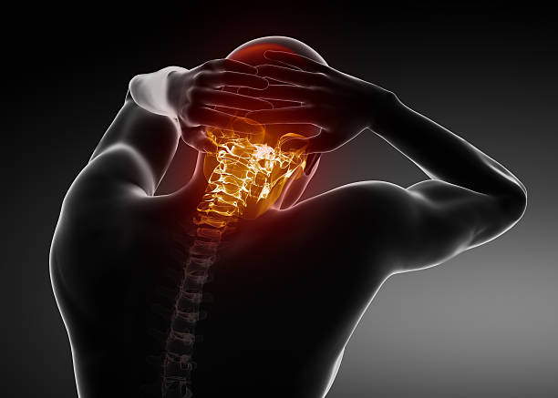 Migraine concept - HEADACHE Pain in cervical spine part cervical vertebrae photos stock pictures, royalty-free photos & images