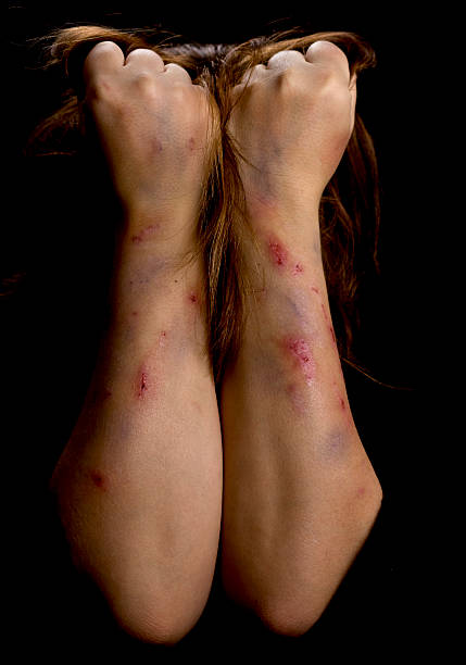 Violence victim Violence victim self harm photos stock pictures, royalty-free photos & images