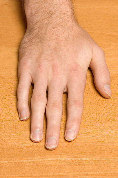 istock Male hand in need of manicure 153768124