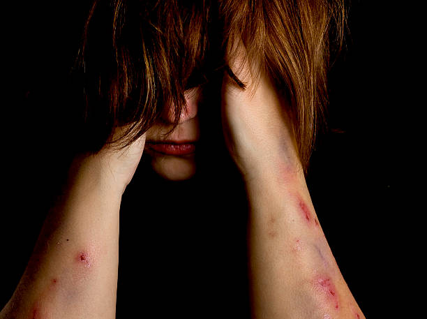 Woman with bruises and cuts on her arm due to violence Violence victim self harm photos stock pictures, royalty-free photos & images