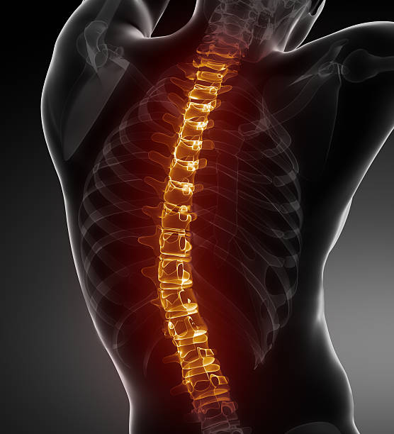 columna vertebral problemas médicos vista posterior - espalda partes del cuerpo fotos fotografías e imágenes de stock