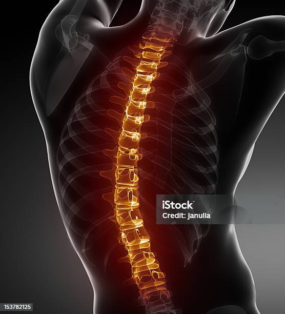 Dorsale Problemi Medici Vista Posteriore - Fotografie stock e altre immagini di Chiropratica - Chiropratica, Spina dorsale - Parte del corpo, Immagine a raggi X