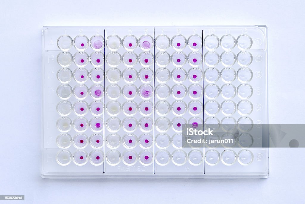 HIV-Test - Lizenzfrei AIDS Stock-Foto