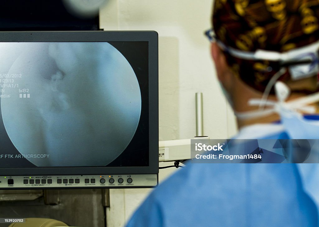 Arthorscopy cirurgia - Royalty-free Cirurgião Foto de stock