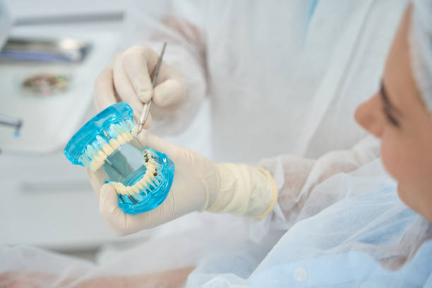 istock Doctor orthodontist shows patient model with dental implants and veneers 1539337325