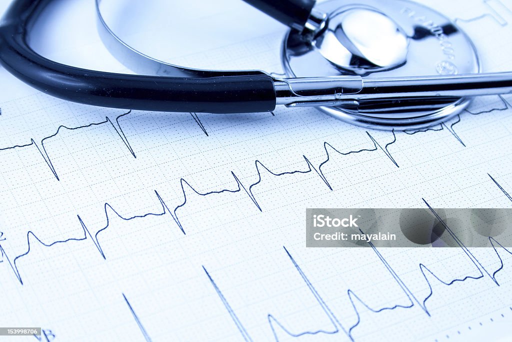 Cardiogram with stethoscope Analyzing Stock Photo