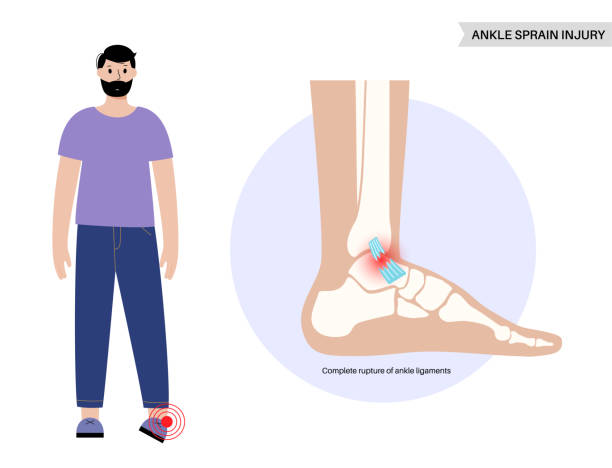 Sprained ankle injury vector art illustration